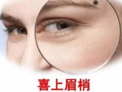 眉毛上面长痣好不好 面相眉毛有痣命运如何