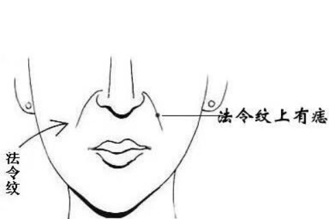 法令纹有痣代表着什么？