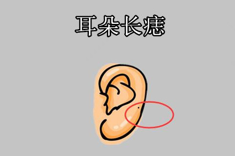 耳朵长痣代表什么意思？